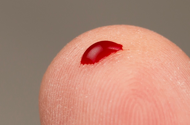 Người nhóm máu O dễ bị muỗi cắt nhiều hơn 83 % so với nhóm máu khác