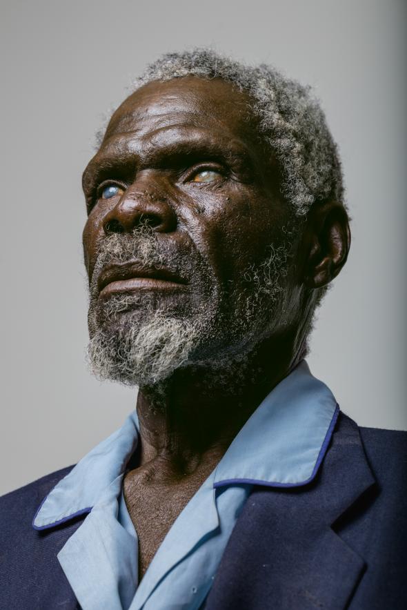 Gerd Gamanab, 67 tuổi, tìm cách điều trị quá muộn: Năm của lao động trong ánh mặt trời Namibia và bụi bị phá hủy giác mạc của mình. mù lòa của ông có khả năng có thể đã được ngăn chặn.