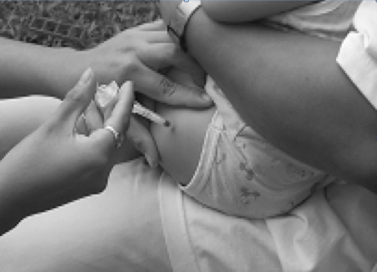  Vaccine ComBE Five được tiêm ở vị trí mặt ngoài giữa đùi trẻ 2-3-4 tháng tuổi. 